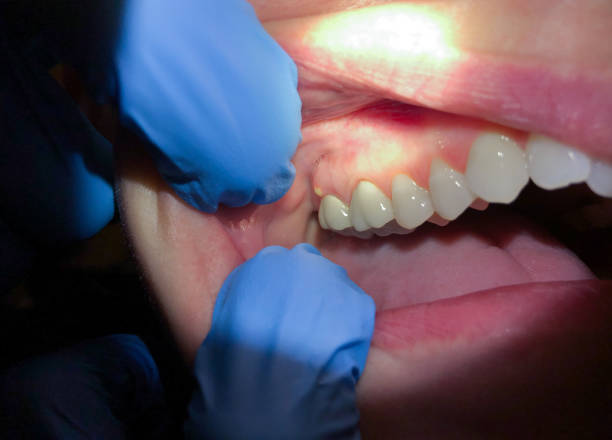 Best Pediatric Emergency Dentist in Lyndhurst, OH