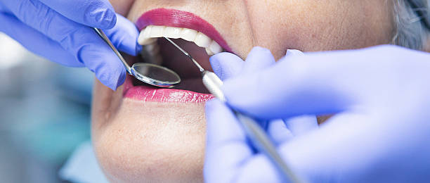 Best Emergency Treatment for Dental Infections or Abscesses in Lyndhurst, OH